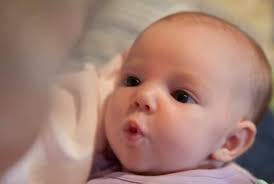 Hội chứng Freeman-Sheldon - Hình ảnh minh họa